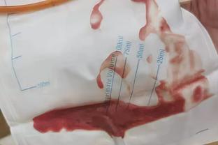 活塞官方：奥萨尔-汤普森&斯图尔特赛季报销 前者正接受血栓治疗